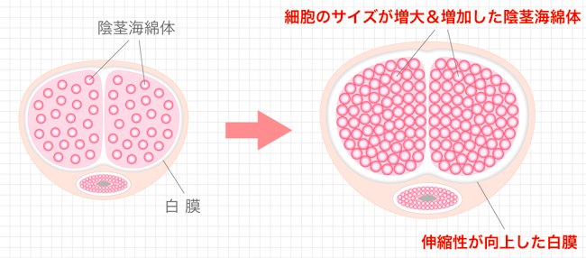 海綿体 大きく